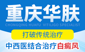 白癜风方面的知识
