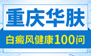 引发白癜风病因是哪些