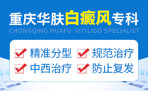 白癜风初期症状是什么原因