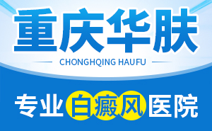 治疗白癜风时应该注意什么