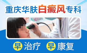 女性得了白癜风如何预防扩散